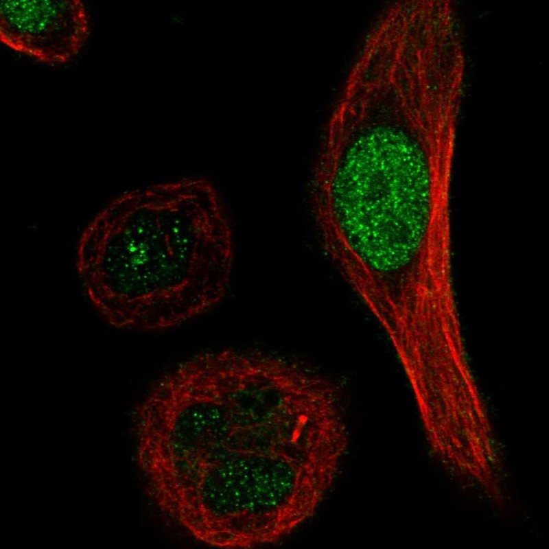 Atlas Antibodies Anti-XRCC3 Antibody