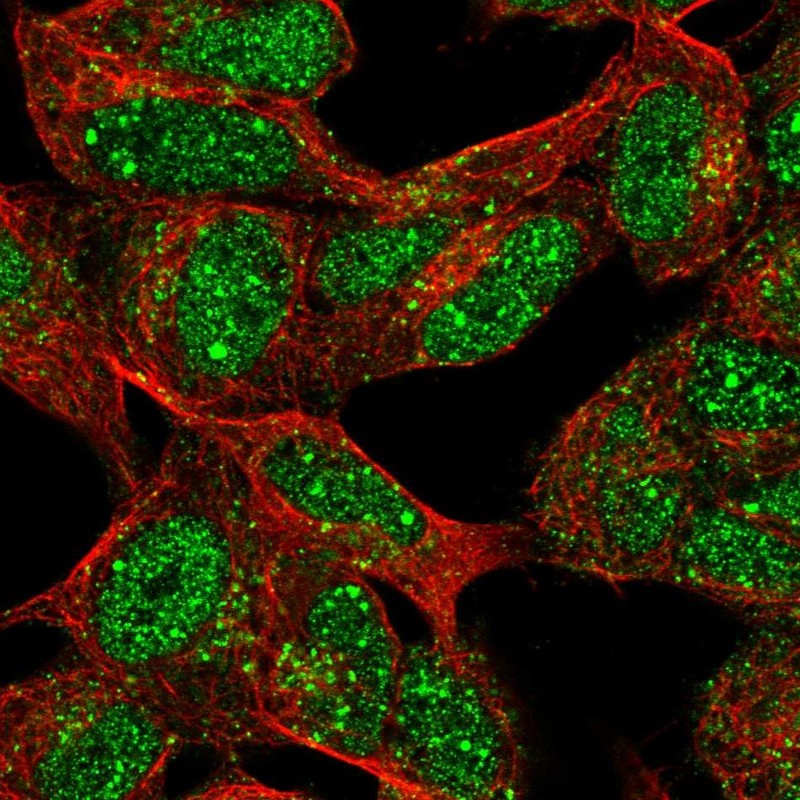 Atlas Antibodies Anti-XRCC2 Antibody