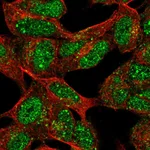 Atlas Antibodies Anti-XRCC2 Antibody