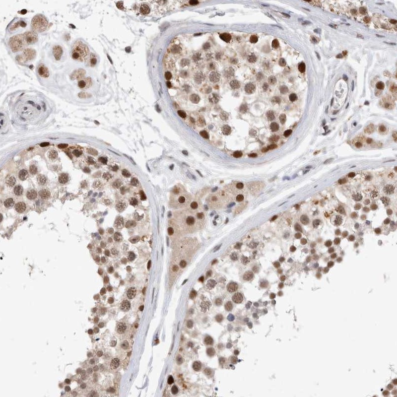 Atlas Antibodies Anti-XRCC5 Antibody