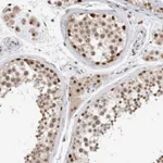 Atlas Antibodies Anti-XRCC5 Antibody