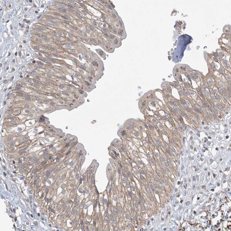 Atlas Antibodies Anti-XRN1 Antibody