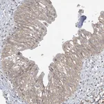 Atlas Antibodies Anti-XRN1 Antibody