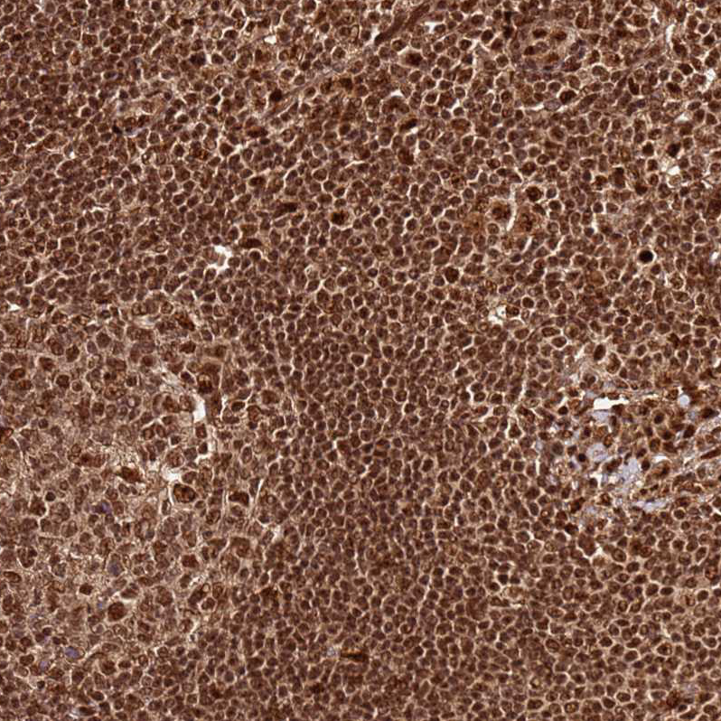 Atlas Antibodies Anti-XRN2 Antibody