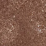 Atlas Antibodies Anti-XRN2 Antibody