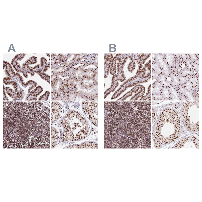 Atlas Antibodies Anti-XRCC6 Antibody