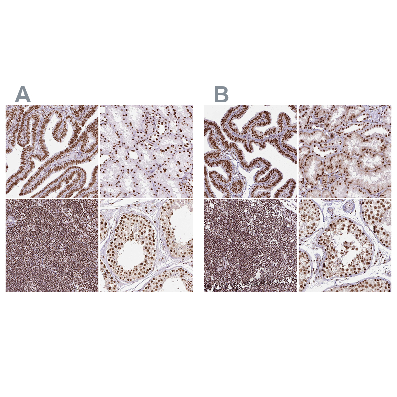 Atlas Antibodies Anti-XRCC6 Antibody
