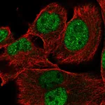 Atlas Antibodies Anti-XRRA1 Antibody