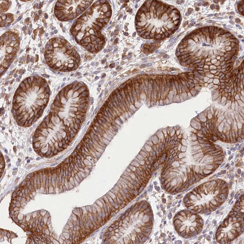 Atlas Antibodies Anti-XYLB Antibody