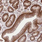 Atlas Antibodies Anti-XYLB Antibody