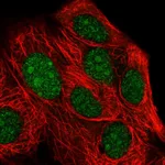 Atlas Antibodies Anti-XRN2 Antibody