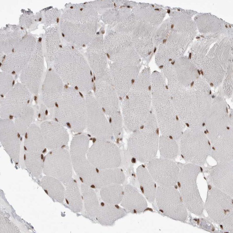 Atlas Antibodies Anti-YAF2 Antibody