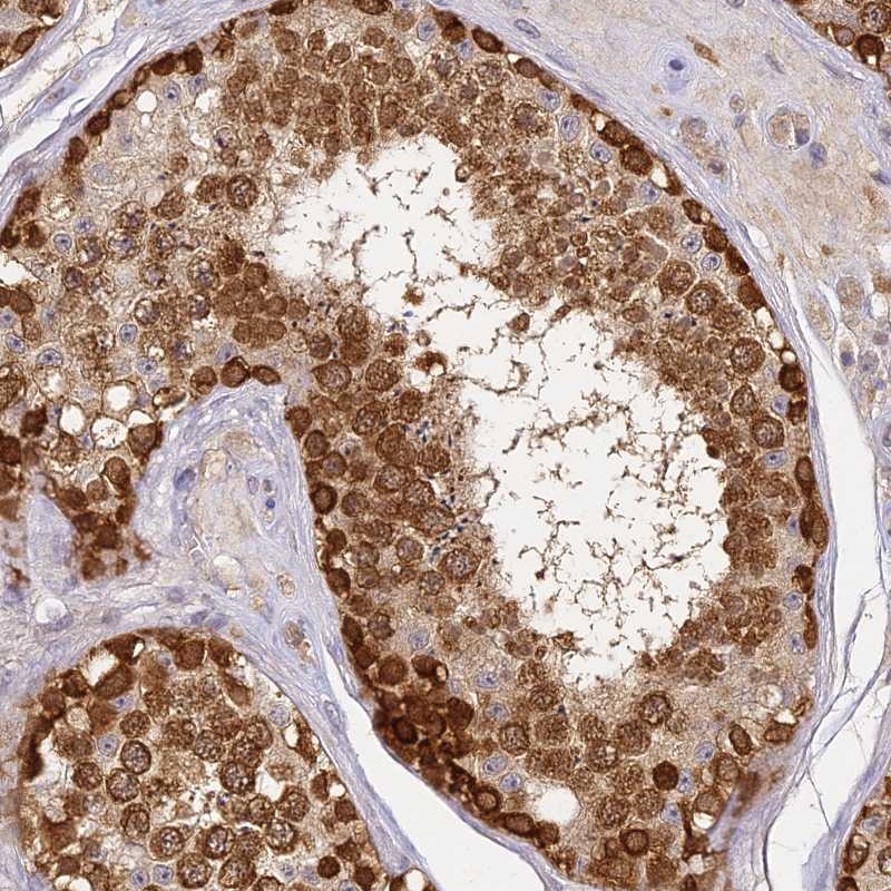 Atlas Antibodies Anti-YAE1D1 Antibody
