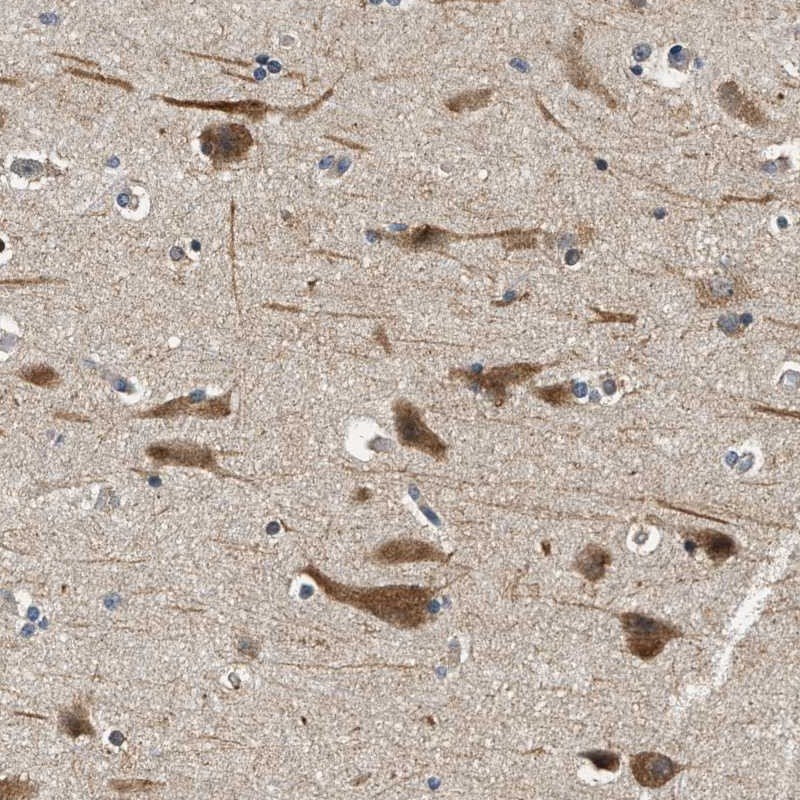 Atlas Antibodies Anti-YAE1D1 Antibody