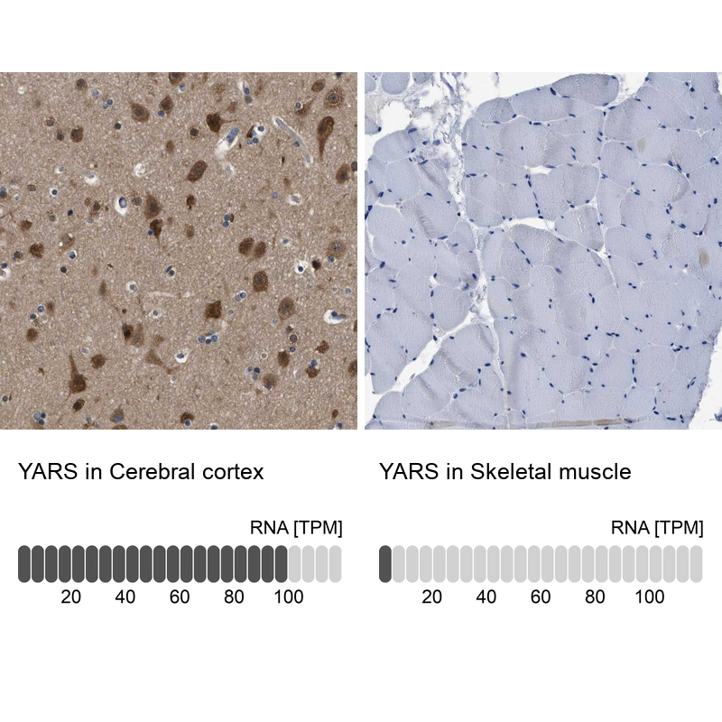Atlas Antibodies Anti-YARS Antibody