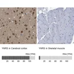 Atlas Antibodies Anti-YARS Antibody