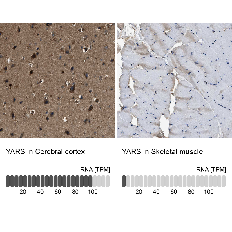 Atlas Antibodies Anti-YARS Antibody