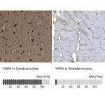Atlas Antibodies Anti-YARS Antibody