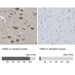 Atlas Antibodies Anti-YARS Antibody