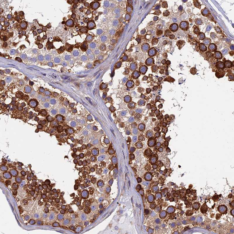 Atlas Antibodies Anti-YBX1 Antibody