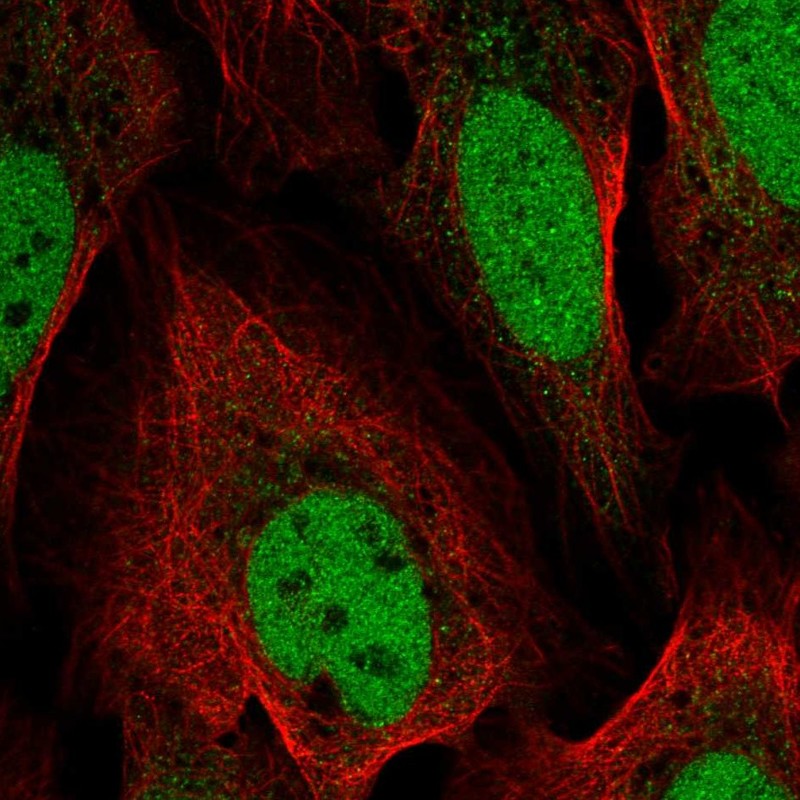 Atlas Antibodies Anti-YEATS4 Antibody