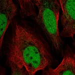 Atlas Antibodies Anti-YEATS4 Antibody