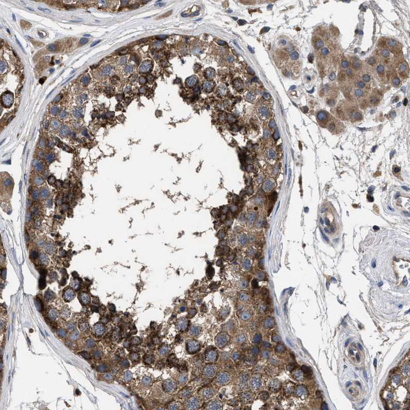 Atlas Antibodies Anti-YBEY Antibody