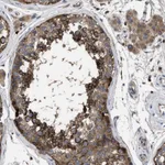 Atlas Antibodies Anti-YBEY Antibody