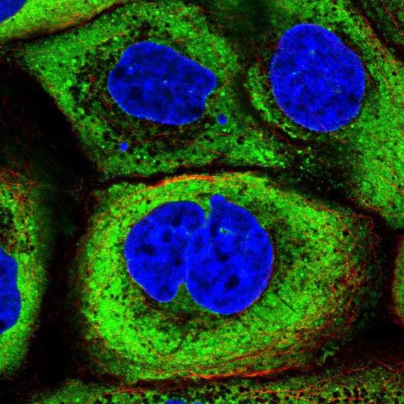 Atlas Antibodies Anti-YBX1 Antibody