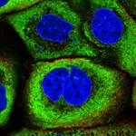 Atlas Antibodies Anti-YBX1 Antibody