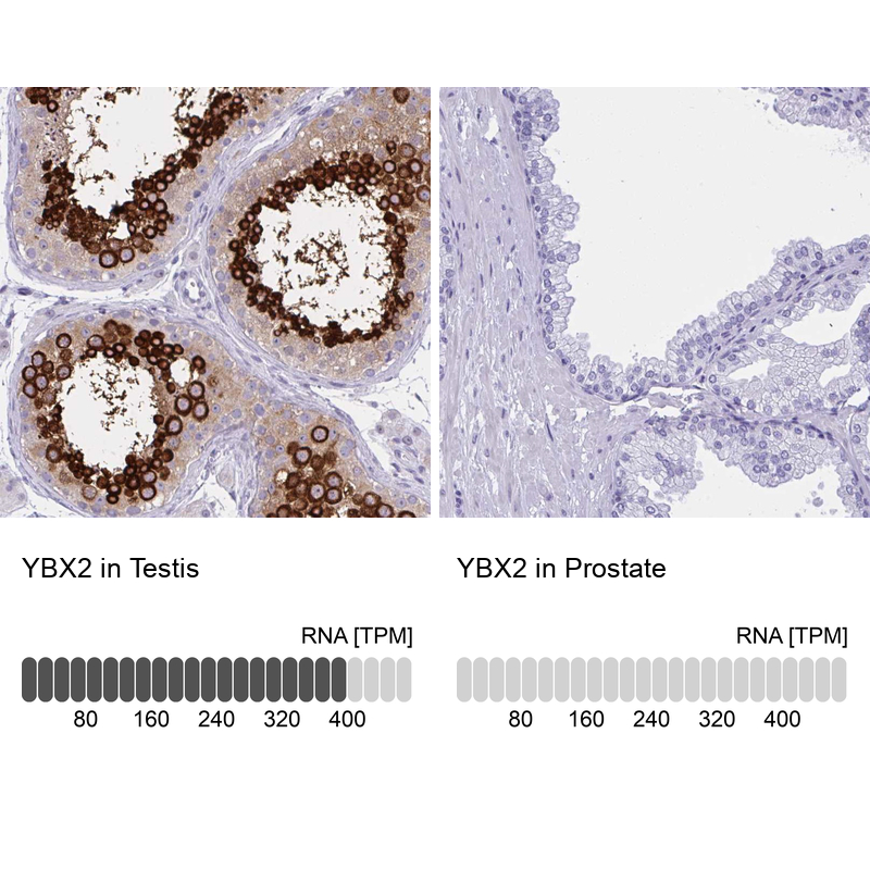 Atlas Antibodies Anti-YBX2 Antibody
