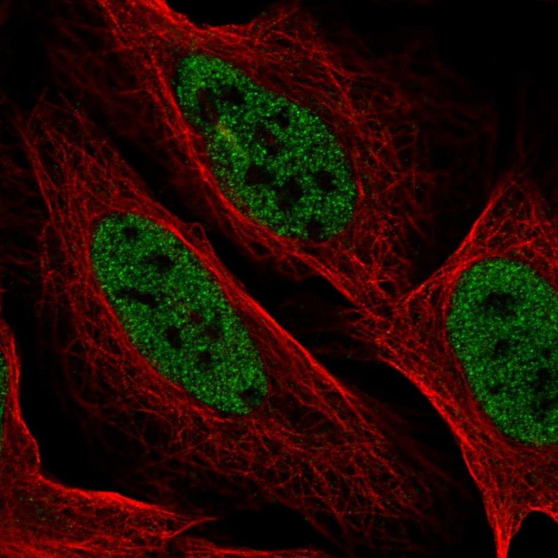 Atlas Antibodies Anti-YDJC Antibody