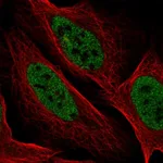 Atlas Antibodies Anti-YDJC Antibody
