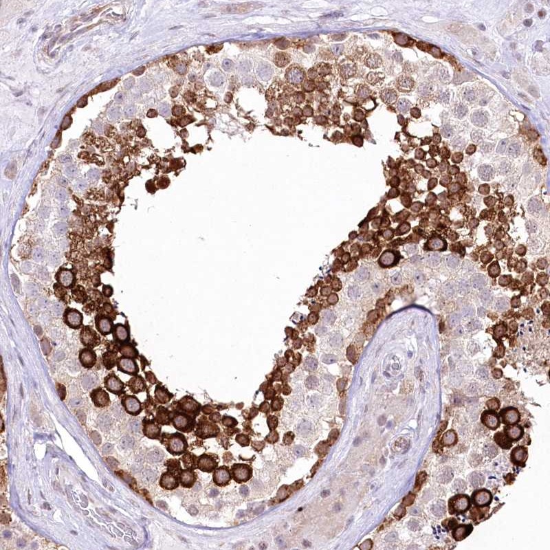 Atlas Antibodies Anti-YBX3 Antibody