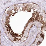Atlas Antibodies Anti-YBX3 Antibody