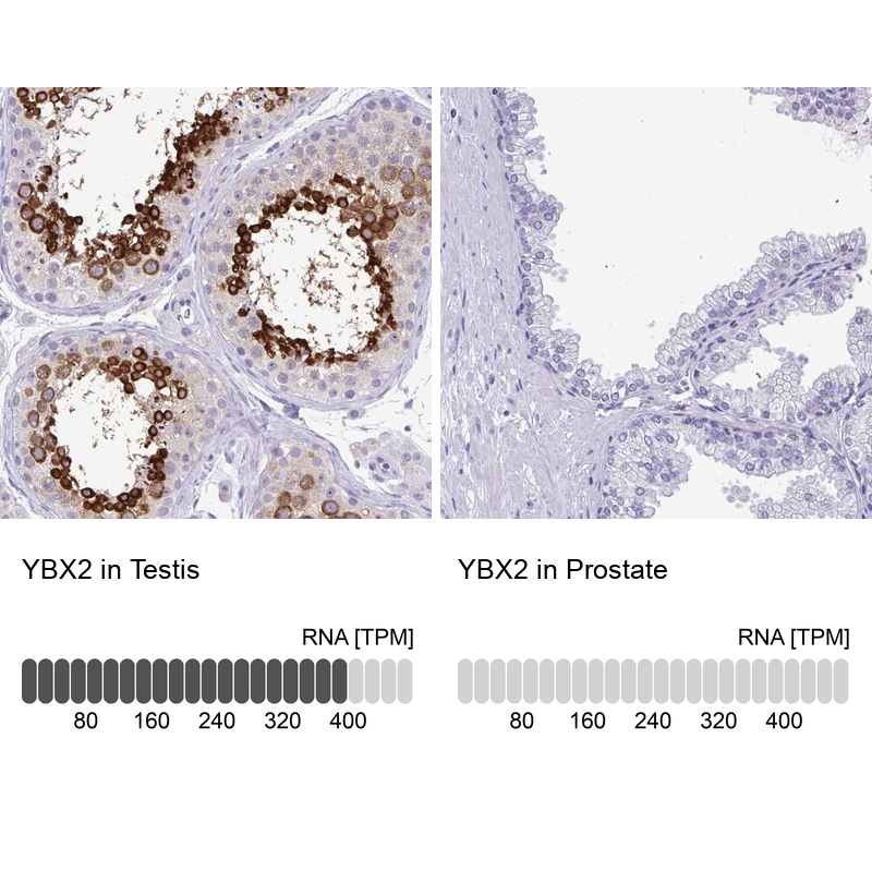 Atlas Antibodies Anti-YBX2 Antibody