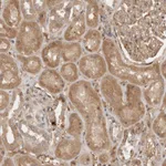 Atlas Antibodies Anti-YES1 Antibody