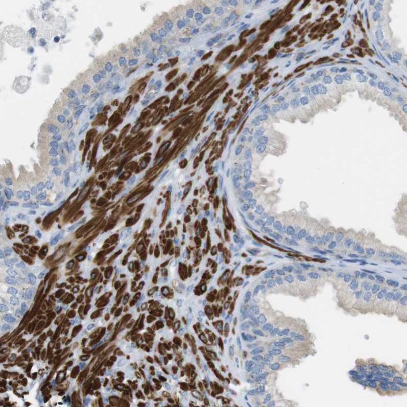 Atlas Antibodies Anti-YIF1A Antibody
