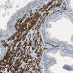 Atlas Antibodies Anti-YIF1A Antibody