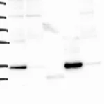 Atlas Antibodies Anti-YIPF1 Antibody