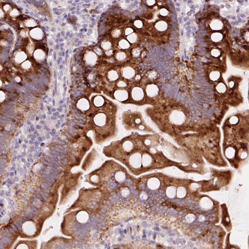Atlas Antibodies Anti-YIF1B Antibody