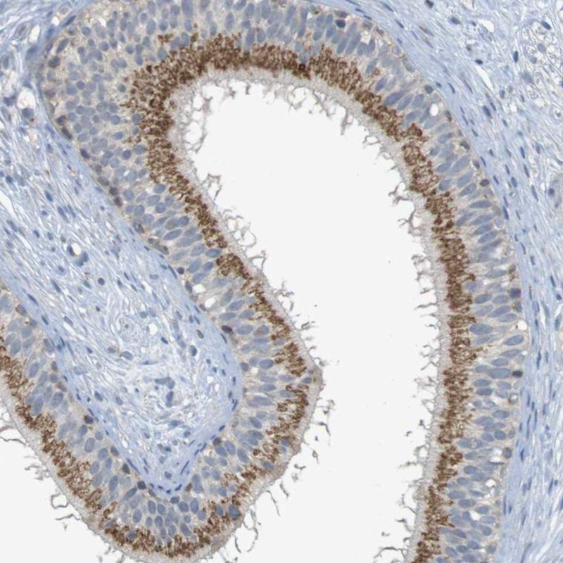 Atlas Antibodies Anti-YIPF3 Antibody