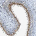 Atlas Antibodies Anti-YIPF3 Antibody