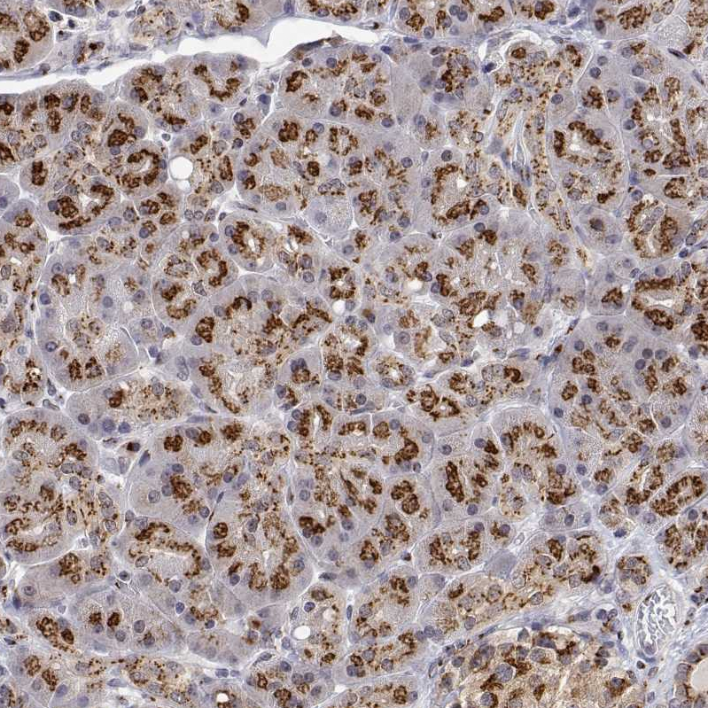 Atlas Antibodies Anti-YIPF3 Antibody