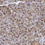 Atlas Antibodies Anti-YIPF3 Antibody