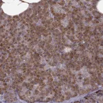 Atlas Antibodies Anti-YIPF5 Antibody