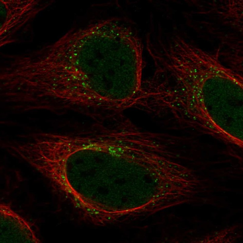 Atlas Antibodies Anti-YIPF5 Antibody