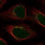 Atlas Antibodies Anti-YIPF5 Antibody