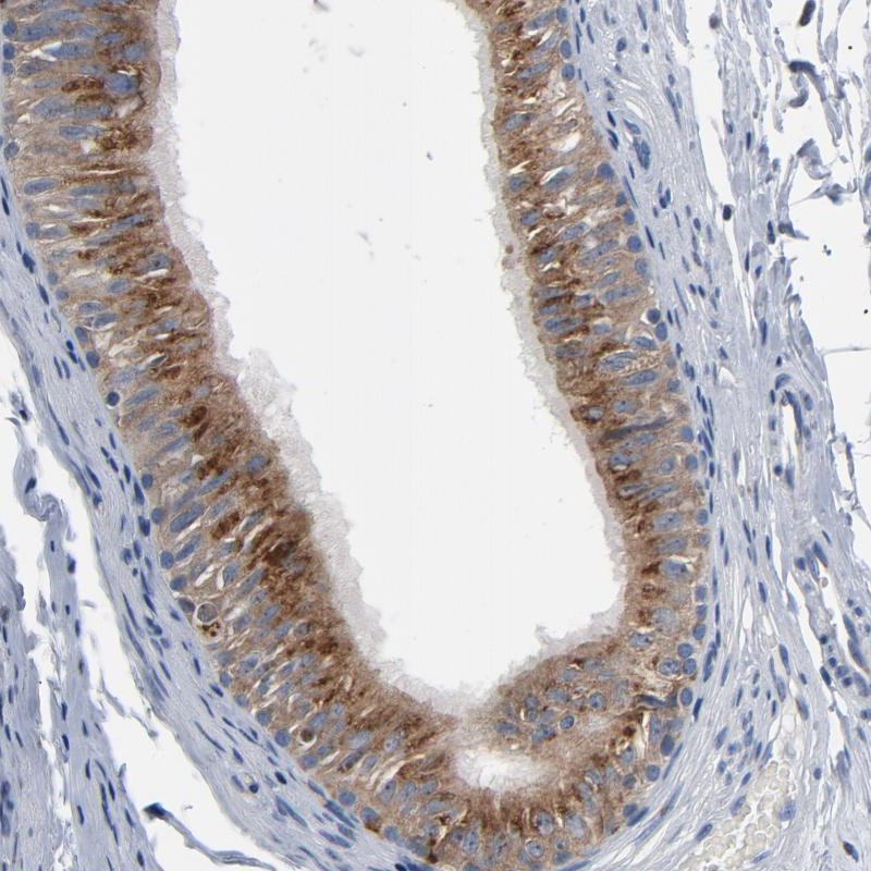 Atlas Antibodies Anti-YIPF6 Antibody