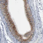 Atlas Antibodies Anti-YIPF6 Antibody